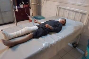 طالبان در پکتیکا دو کودک را زخمی نمودند