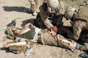 پیوند آلت تناسلی سرباز زخمی امریکایی در افغانستان