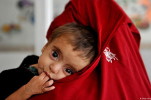 3.2 میلیون کودک افغان از سوءتغذیه رنج خواهند برد
