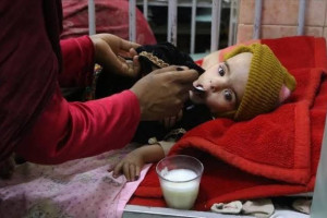 بیش از ۴.۷ میلیون زن و کودک در افغانستان به درمان فوری سوءتغذیه نیاز دارند