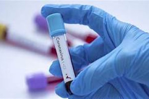   ثبت 73 مورد جدید ابتلا به ویروس کرونا در 24 ساعت گذشته
