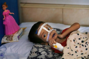 ۱۳ هزار نوزاد افغان بر اثر سوء تغذیه جان باخته‌اند