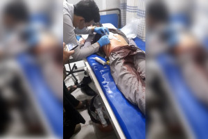 افراد ناشناس یک خبرنگار را در کابل با ضرب چاقو زخمی کردند