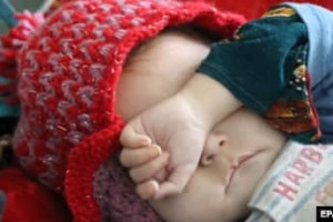 صلیب سرخ از افزایش بیماری فلج مغزی کودکان در کابل خبر داد