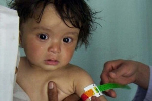  هشدار یونیسف از احتمال مرگ یک میلیون کودک در افغانستان 