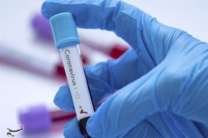 ثبت 62 مورد تازه‌ای ویروس کرونا در 24 ساعت گذشته