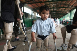  800 هزار افغان از معلولیت‌های‌ مختلف رنج می‌برند