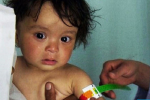 درخواست کمک مالی فوری یونیسف برای کودکان در معرض سوءتغذیه در افغانستان