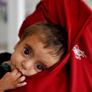 یونیسف-از-هردو-کودک-افغان-یک-تن-مصاب-به-سوءتغذیه-است