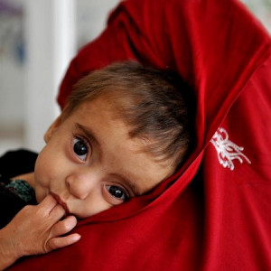 -میلیون-کودک-افغان-از-سوءتغذیه-رنج-خواهند-برد