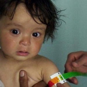 هشدار-یونیسف-از-احتمال-مرگ-یک-میلیون-کودک-در-افغانستان