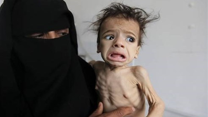 ۱-۸میلیون-کودک-یمنی-با-سوء-تغذیه-مواجه-اند