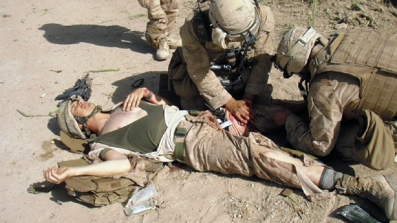 پیوند-آلت-تناسلی-سرباز-زخمی-امریکایی-در-افغانستان