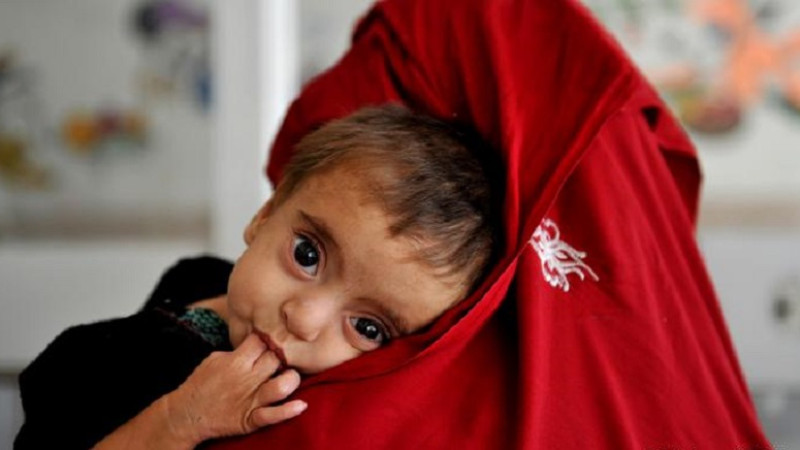 یونیسف-از-هر-دو-کودک-افغان-یکی-آن-به-سوءتغذیه-حاد-دچار-خواهد-شد