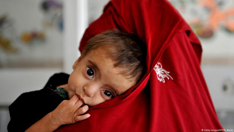 -میلیون-کودک-افغان-از-سوءتغذیه-رنج-خواهند-برد