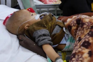 یونیسف از درمان ۱۴۰هزار کودک مبتلا به سوءتغذیه افغان خبر داد