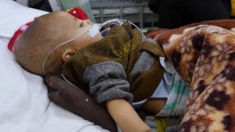 یونیسف-از-درمان-۱۴۰هزار-کودک-مبتلا-به-سوءتغذیه-افغان-خبر-داد