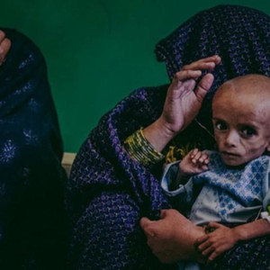 -میلیون-کودک-در-افغانستان-دچار-سوءتغذیه-استند