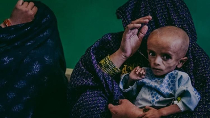-میلیون-کودک-در-افغانستان-دچار-سوءتغذیه-استند