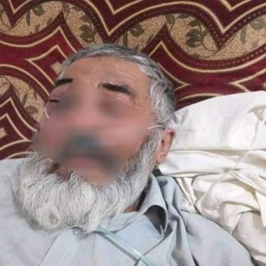 شیوع-بیماری-قارچ-سیاه-در-میان-افراد-مبتلا-به-کرونا